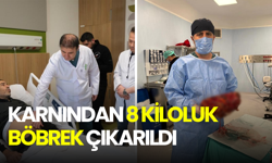 Karnından 8 kiloluk böbrek çıkarıldı