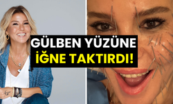 Gülben Ergen yüzüne onlarca iğne taktırdı! Güney Kore tatilinden dikkat çeken paylaşım