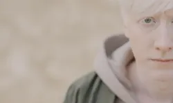 Nadir görülen 5 vücut farklılığı: Heterokromiden situs inversusa