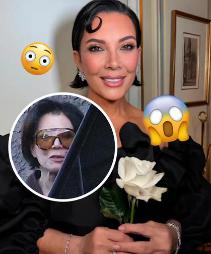 Kris Jenner'ın yüzü 100 bin dolarlık estetik sonrası çöktü: Hukuki süreç başladı