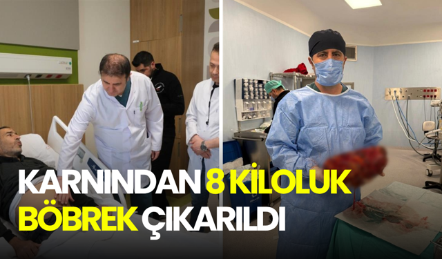 Karnından 8 kiloluk böbrek çıkarıldı