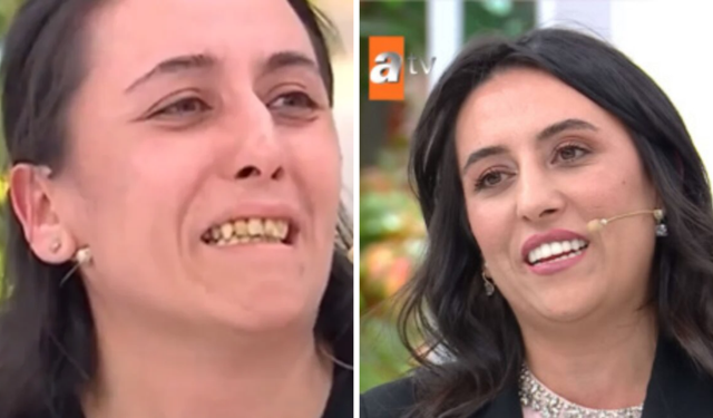 Kocası dişleri yüzünden aşağılamıştı: Esra Erol'da Derya tedavi oldu