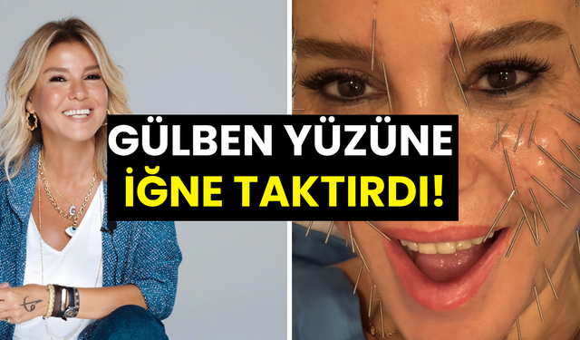 Gülben Ergen yüzüne onlarca iğne taktırdı! Güney Kore tatilinden dikkat çeken paylaşım