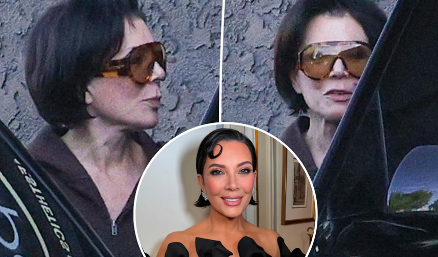 Kris Jenner'ın yüzü 100 bin dolarlık estetik sonrası çöktü: Hukuki süreç başladı
