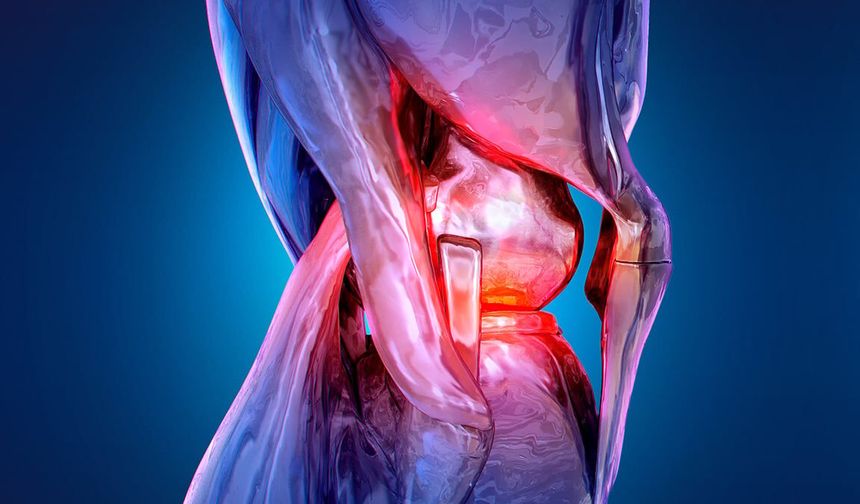 Diz osteoartritinde cerrahiye gerek kalmadan kalıcı rahatlama: 12 ayda ağrı yarı yarıya azaldı
