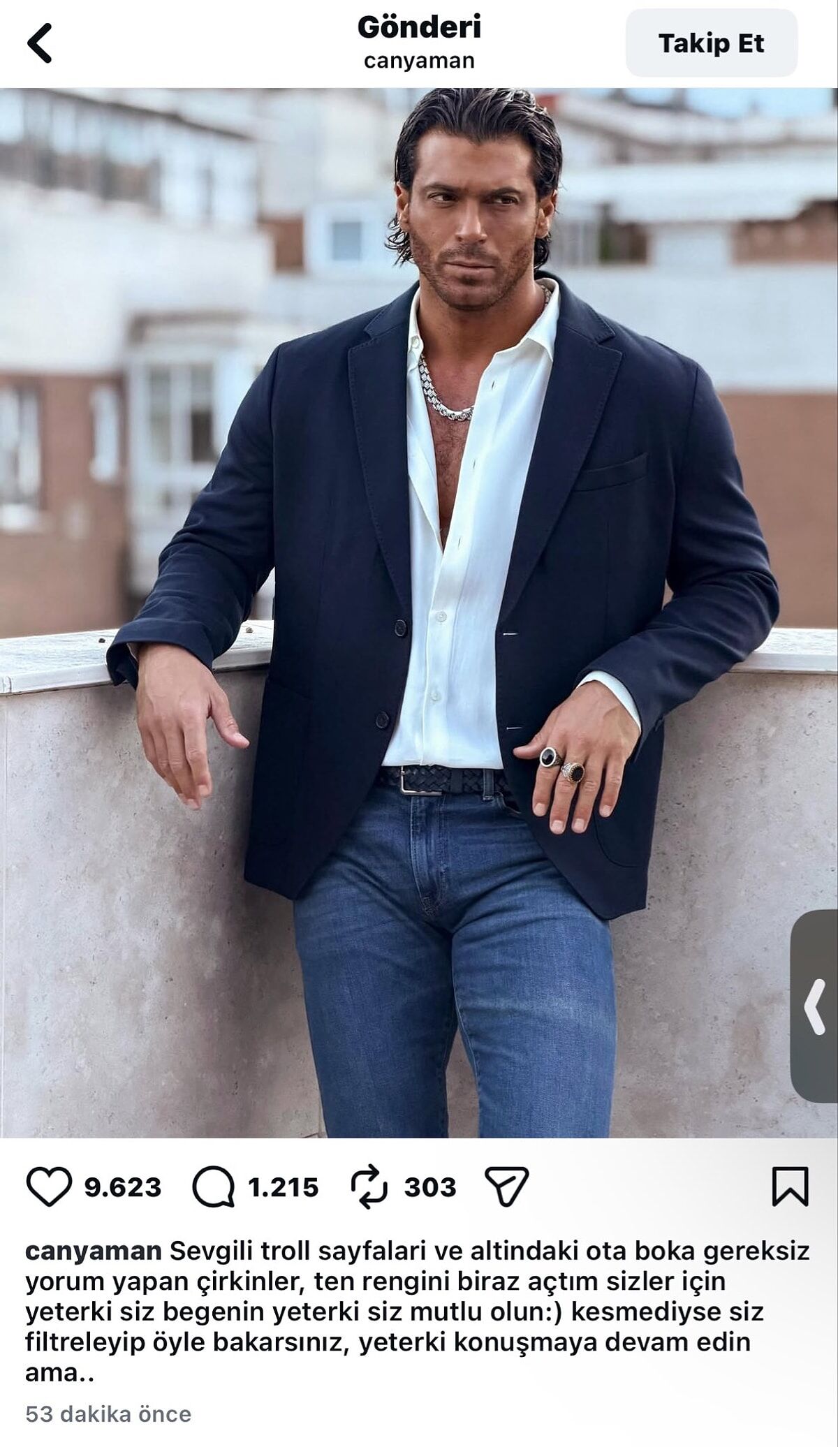Can Yaman Bronz Ten Tartışmasına Sert Çıktı-1